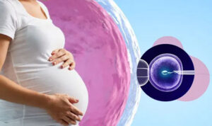 ivf-procedure