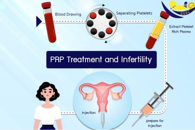 Platelet-Rich Plasma