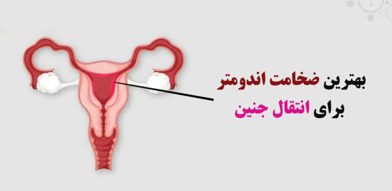 ضخامت آندومتر