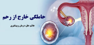 حاملگی خارج از رحم