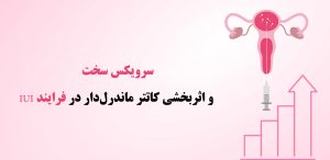 سرویکس